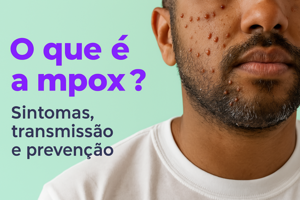 Mpox , sintomas , tratamento e prevenção
